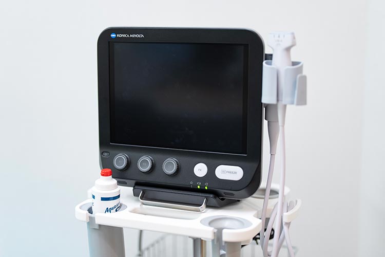 のりまつ整形外科・骨粗しょう症クリニック　超音波診断装置